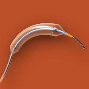 nc-trek-coronary-dilatation-catheter-1.png